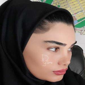 جراحی-بینی-11
