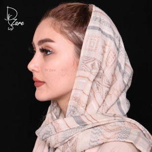 جراحی-بینی-16