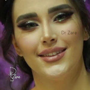 جراحی-بینی-47