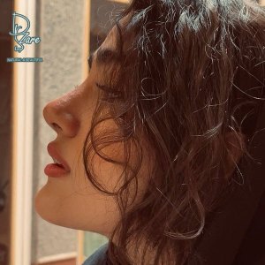 rhinoplasty-127