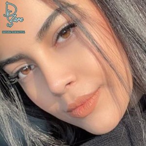 rhinoplasty-128