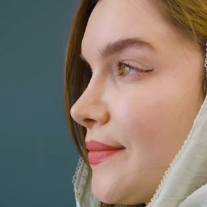 rhinoplasty-140