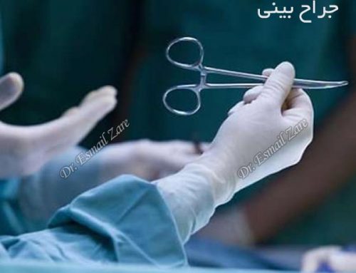 جراح بینی + دکتر اسماعیل زارع