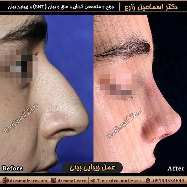 جراح بینی - دکتر زارع