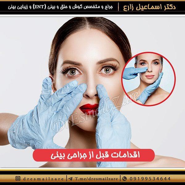 جراحی بینی