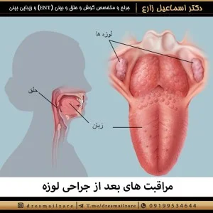 مراقبت های بعد از جراحی لوزه
