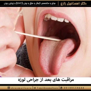 مراقبت های بعد از جراحی لوزه