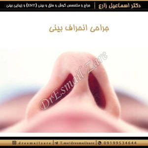 جراحی انحراف بینی - دکتر زارع