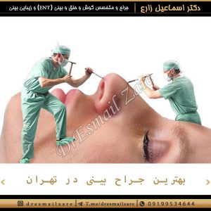 بهترین جراحی بینی در تهران