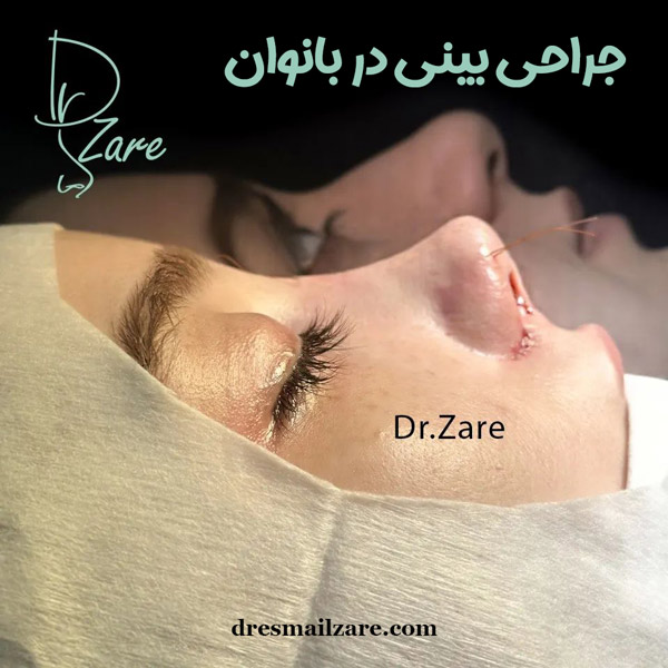 جراحی بینی در بانوان https://dresmailzare.com/