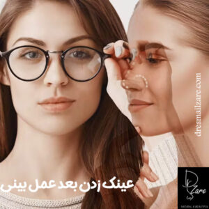 عینک زدن بعد عمل بینی https://dresmailzare.com/