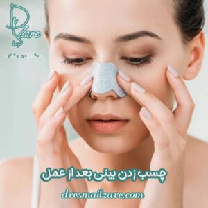 چسب زدن بینی بعد از عمل