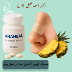 قرص آناهیل بعد از جراحی بینی
