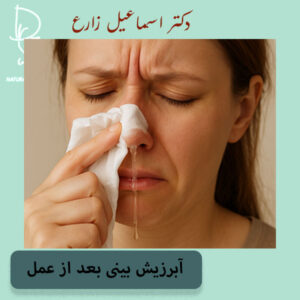 آبریزش بینی بعد از عمل