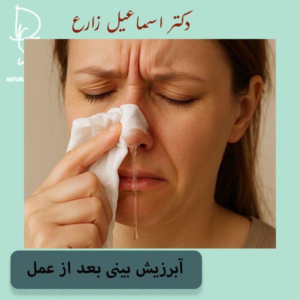 آبریزش بینی بعد از عمل