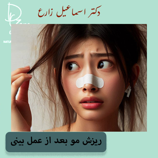 ریزش مو بعد از عمل بینی