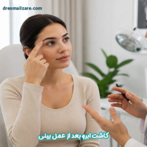 کاشت ابرو بعد از عمل بینی - دکتر اسماعیل زارع