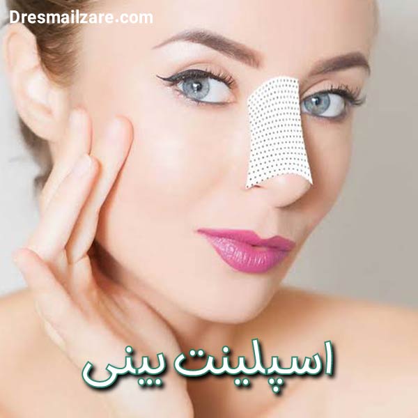 اسپلینت بینی