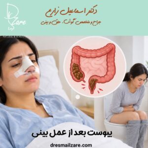 یبوست بعد از عمل بینی