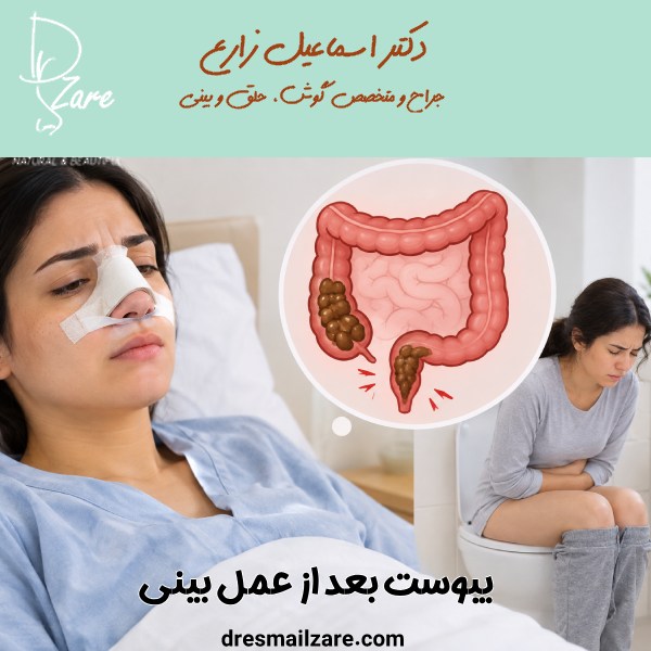 یبوست بعد از عمل بینی